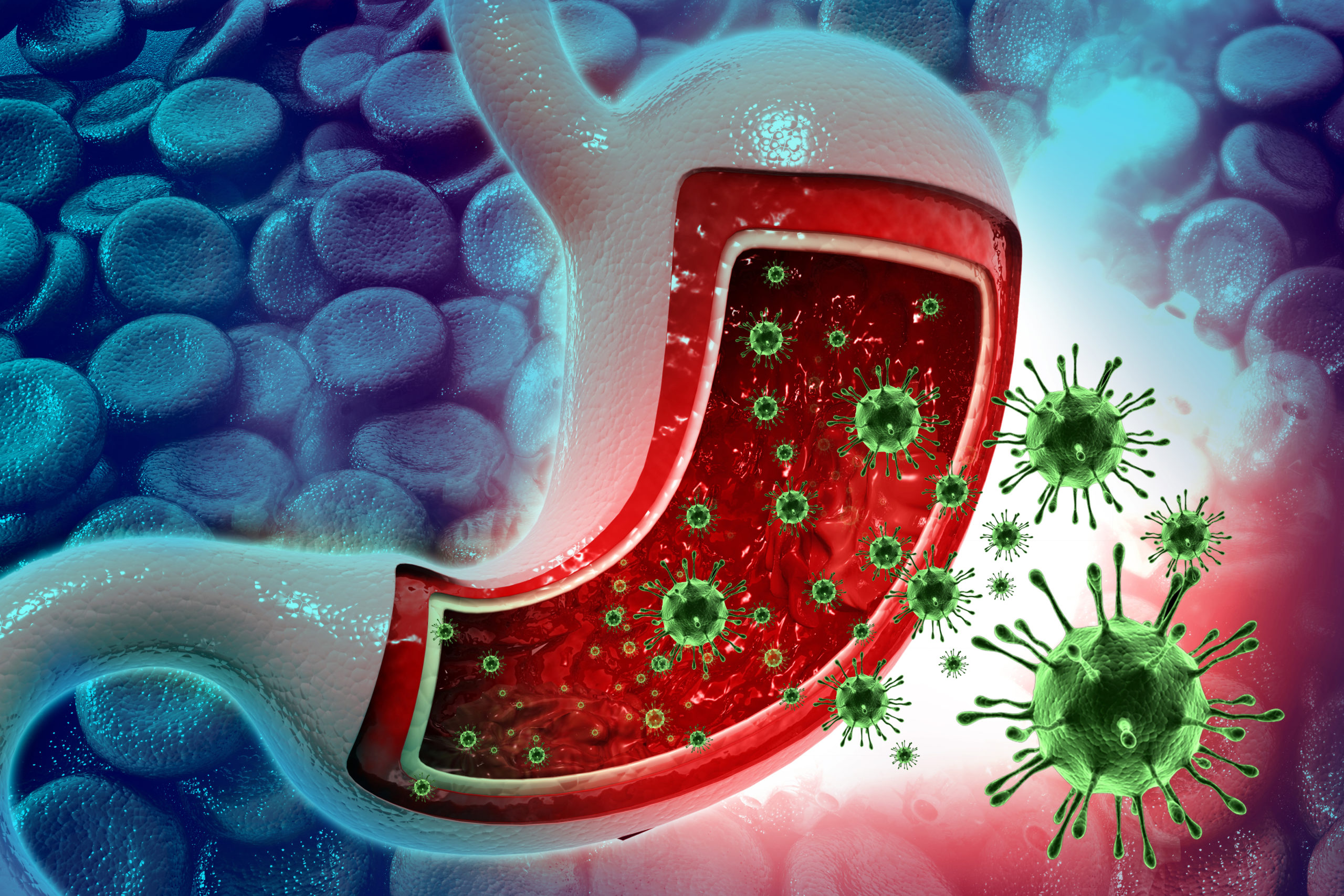 Viral Gastroenteritis Apollo Hospitals