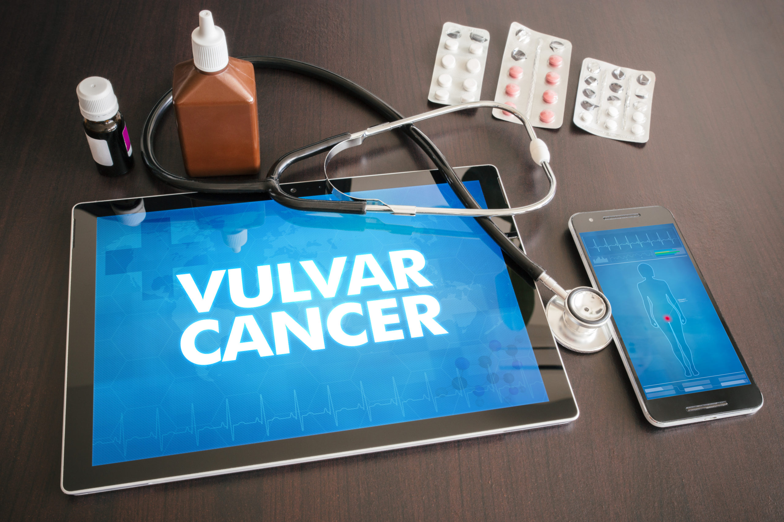 Vulvar Cancer