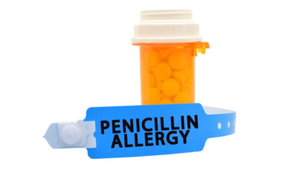 Penicillin Allergy – Causes, symptoms and Treatment