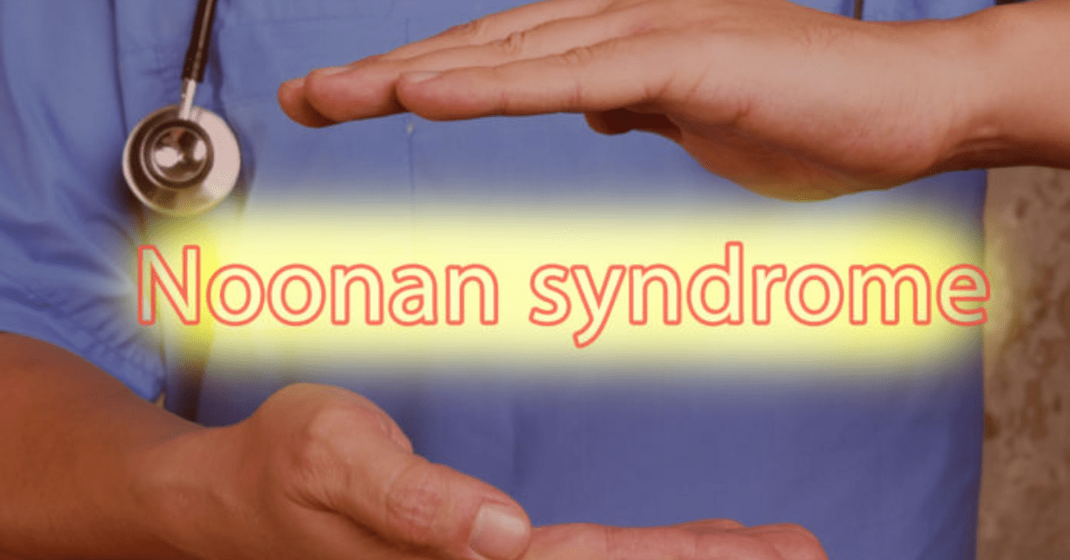 Noonan Syndrome – Causes Symptoms And Treatment