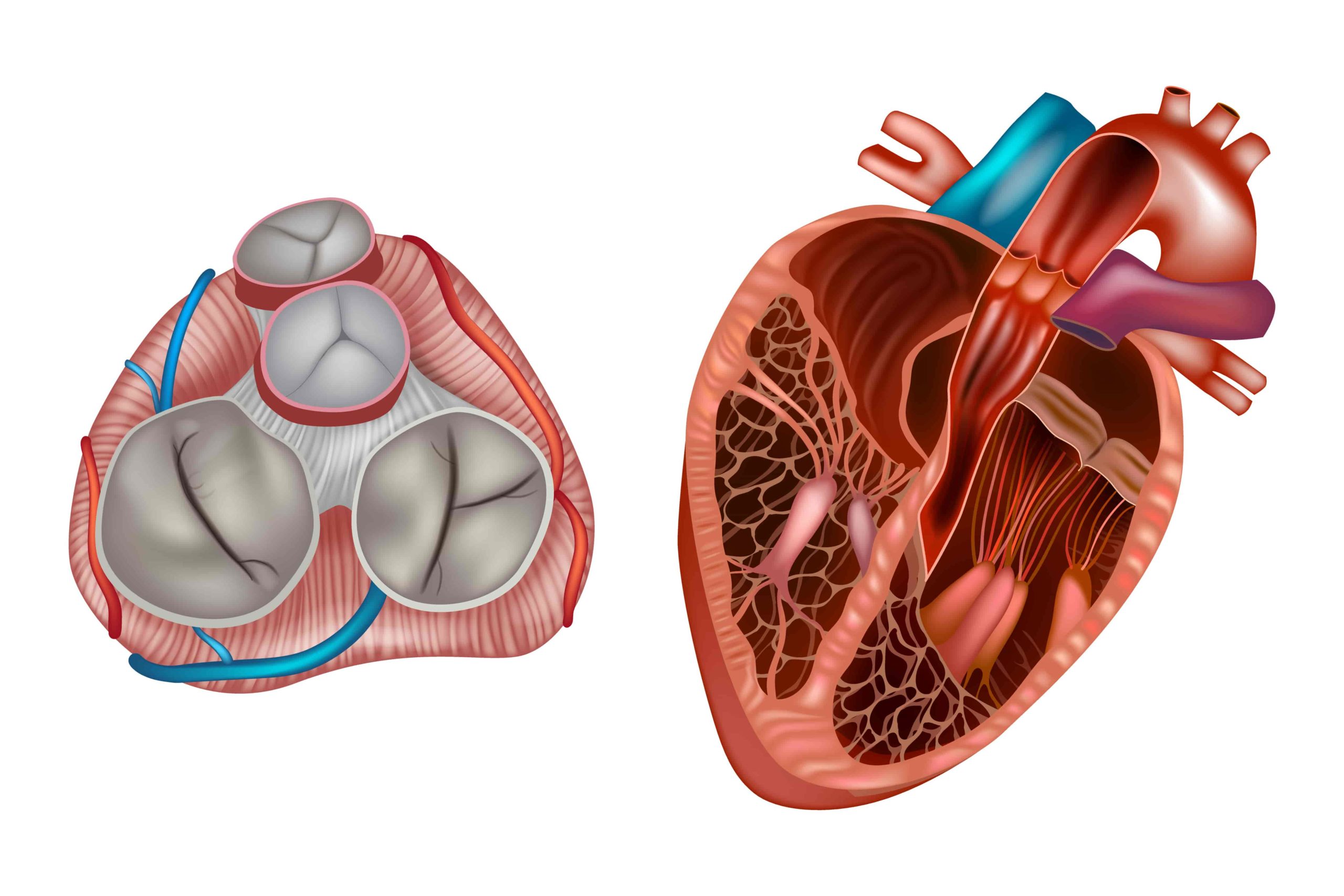 Pulmonary Valve Stenosis