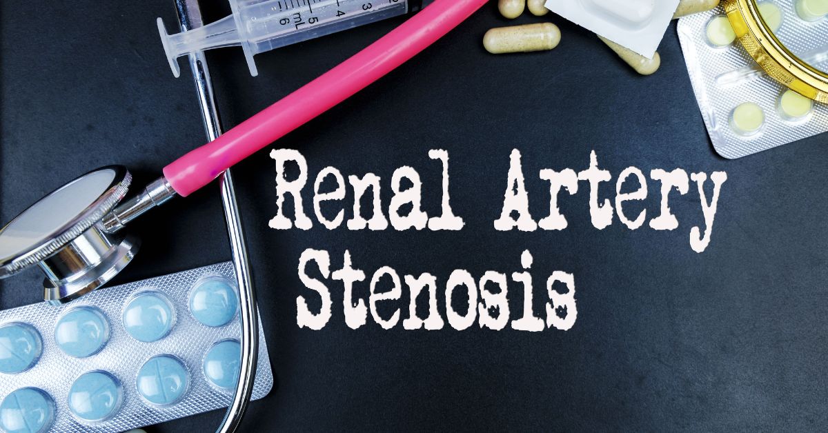 Renal Artery Stenosis – Symptoms, Causes And Treatment