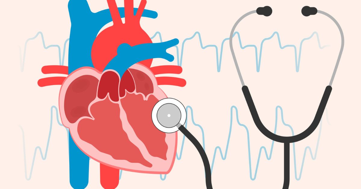 Tricuspid Atresia- Causes, Symptoms and Treatment