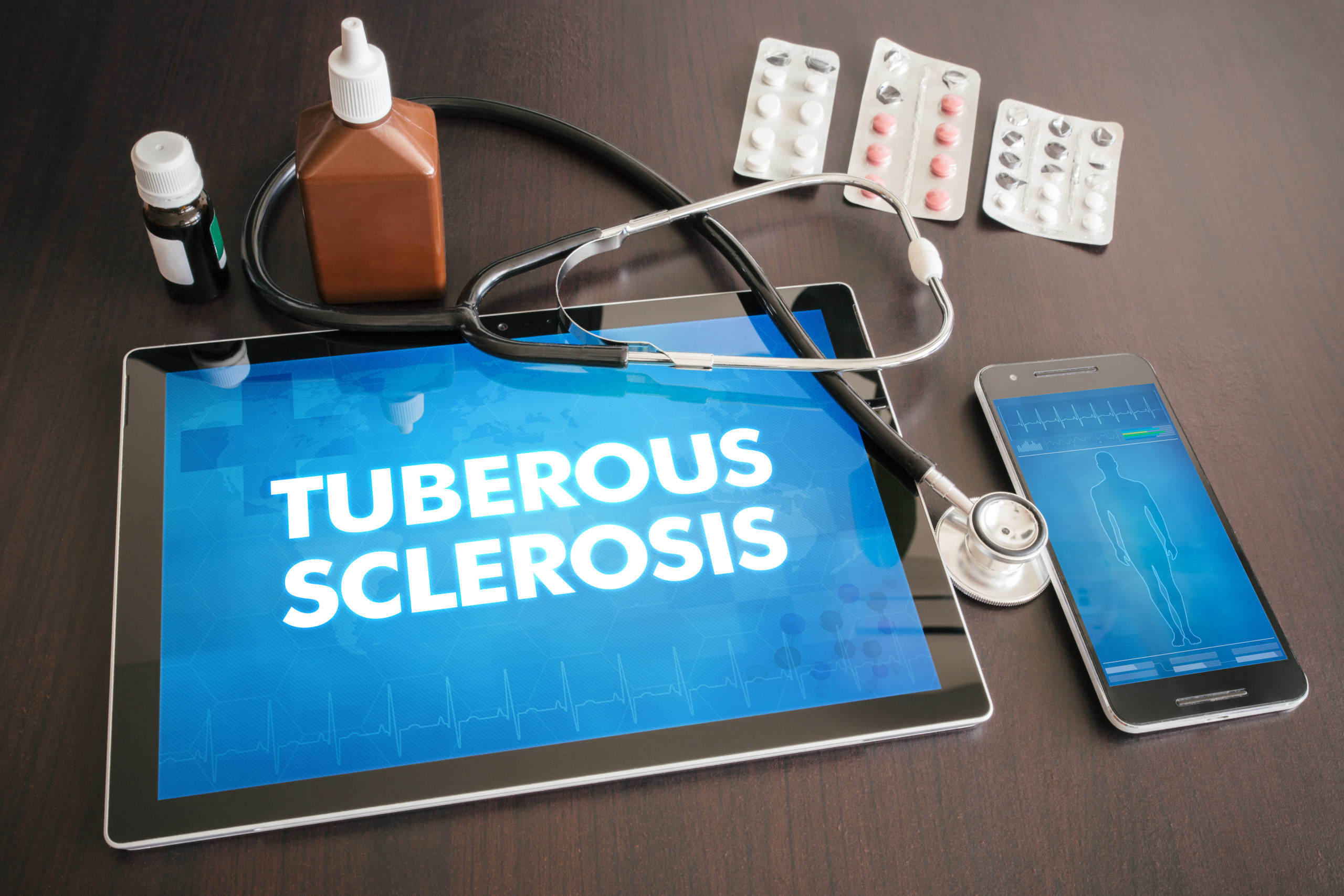 Tuberous Sclerosis: Possible Causes and Treatment Options