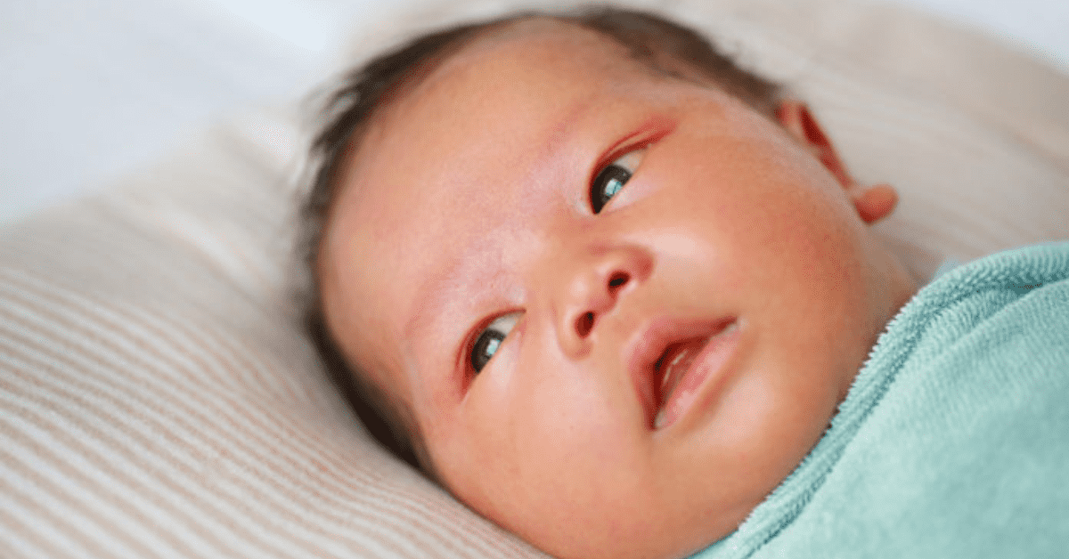 Newborn Jaundice – Causes, Symptoms and Treatment