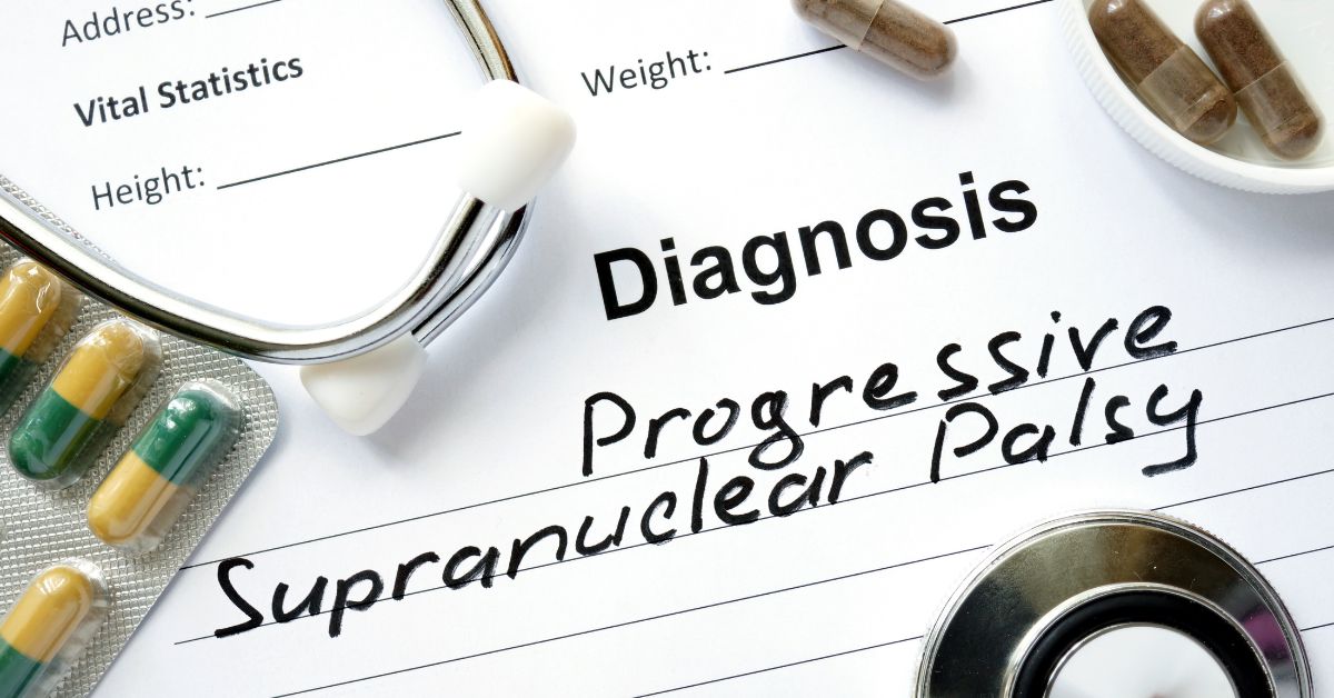 Progressive Supranuclear Palsy – Causes, Symptoms and Treatment