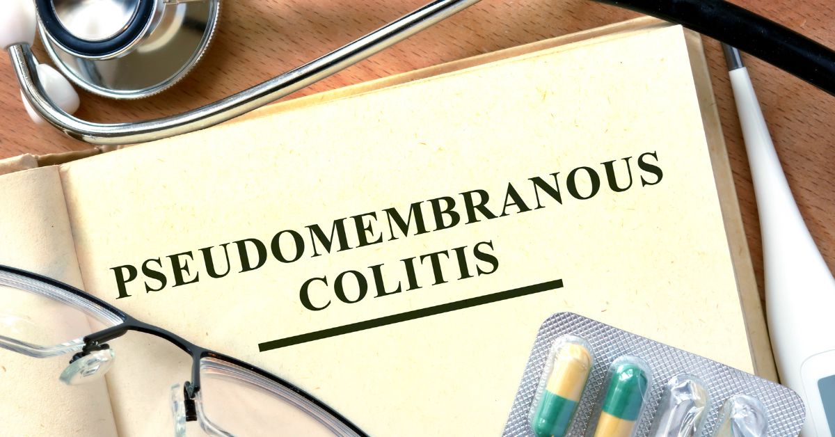 Pseudomembranous Colitis – Causes, Symptoms and Treatment