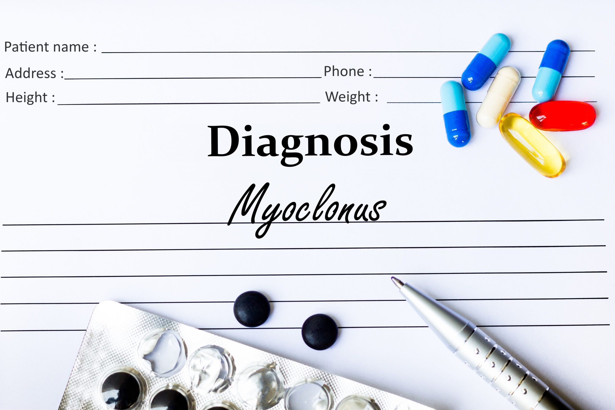 Myoclonus – Causes, Symptoms and Treatment