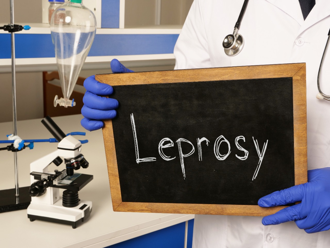 Leprosy – Symptoms, Types, Diagnosis and Treatment