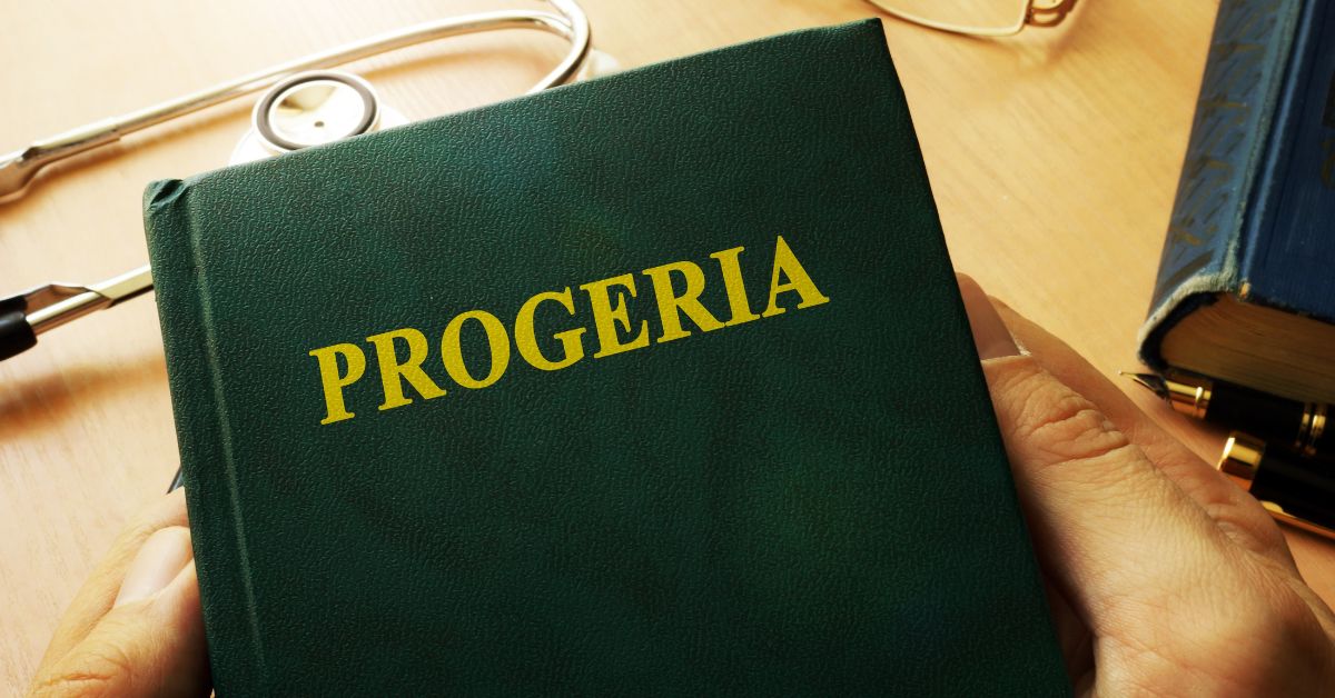 Progeria: Causes, Symptoms, and Treatments