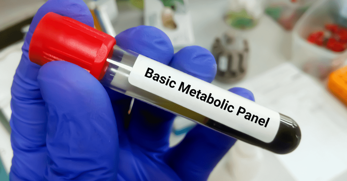 Basic Metabolic Panel