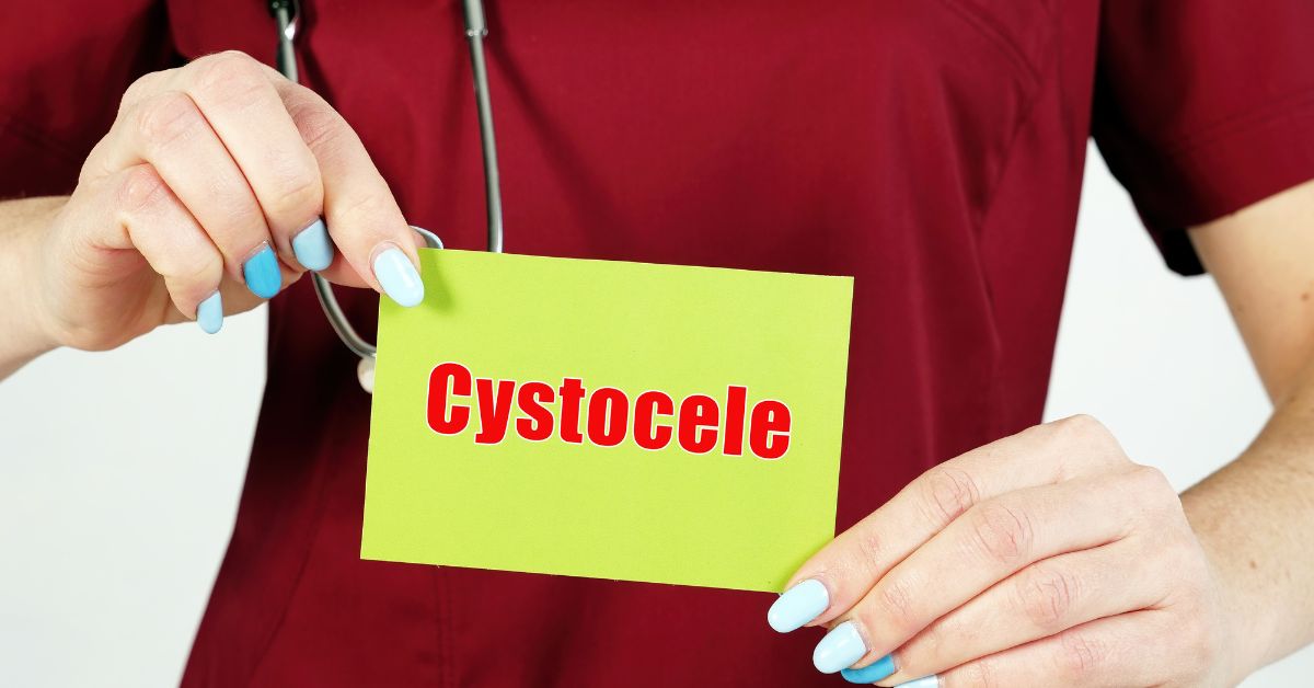 How can Cystocele Heal Naturally?