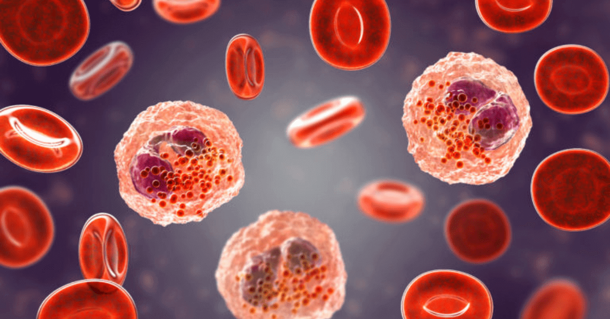 Eosinophilia: Definition, Causes, Symptoms, Treatment & Prevention