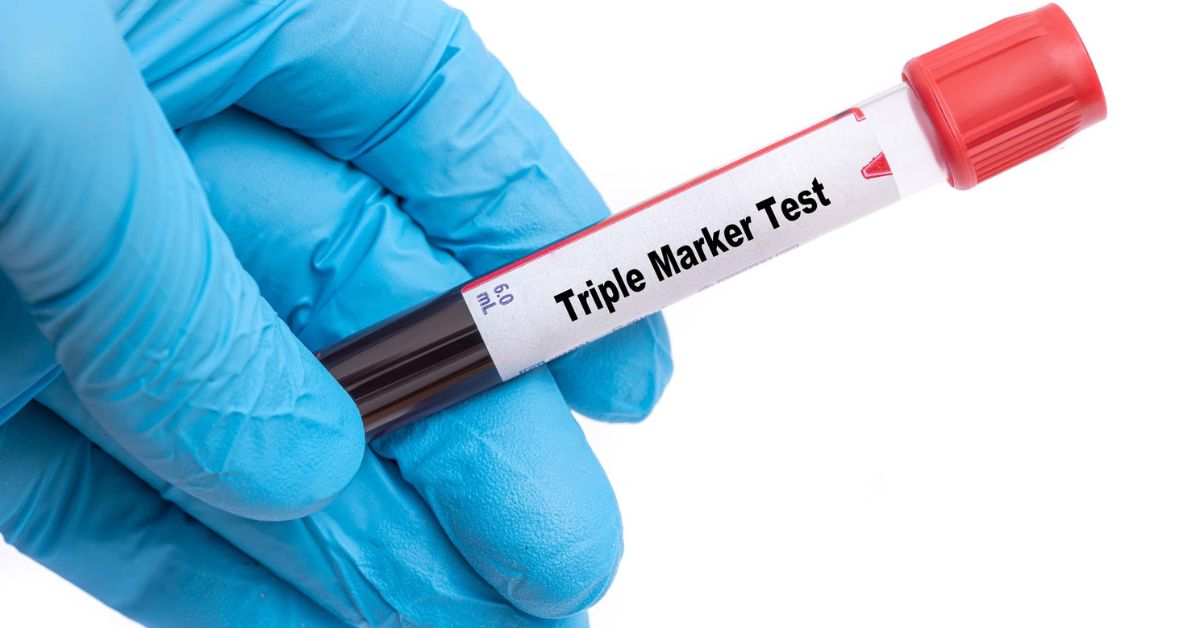 Triple Marker Test – Procedure, When is it required and Results