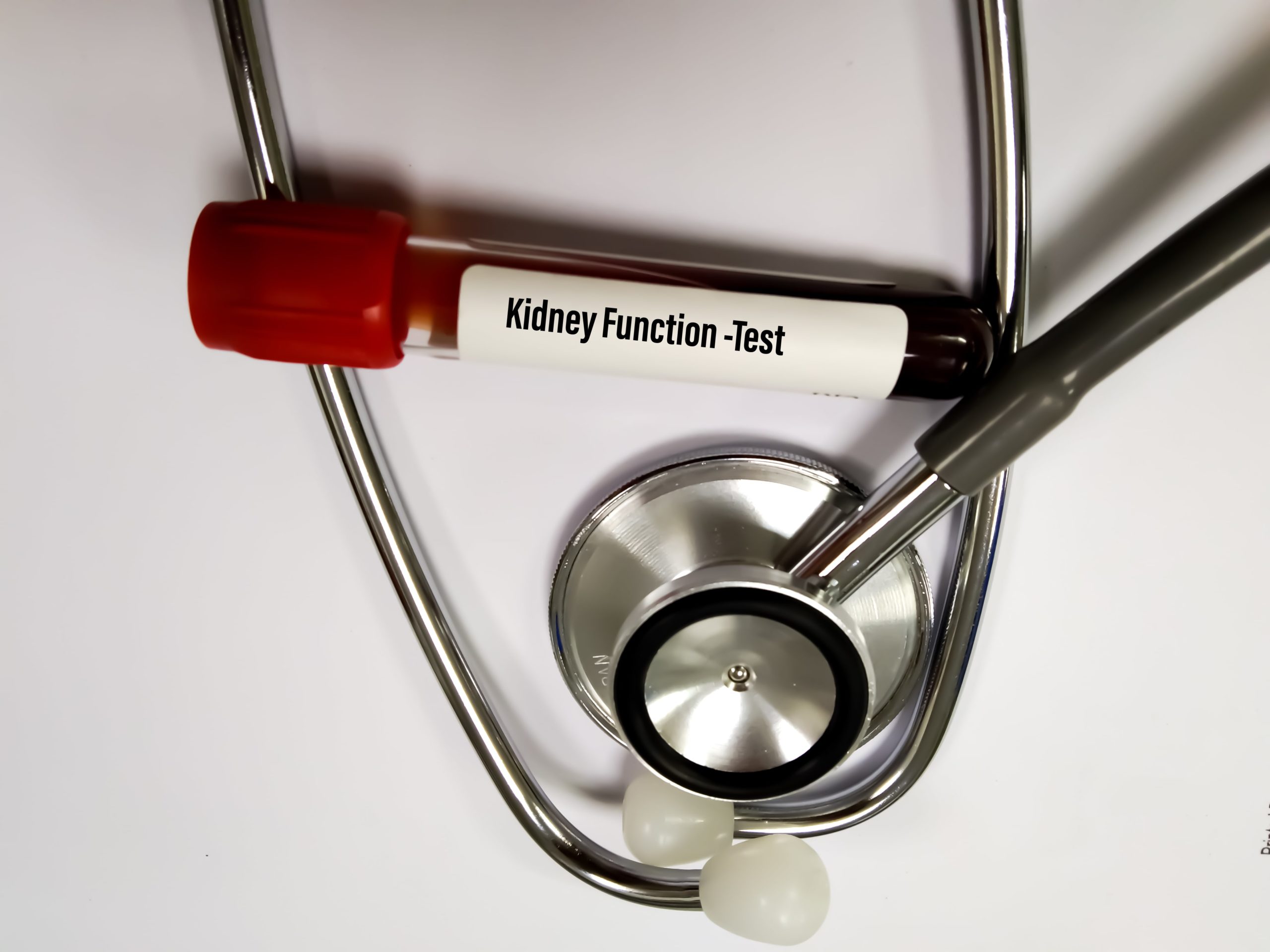 Kidney Function Tests (KFT) – Types, Who Should Get it