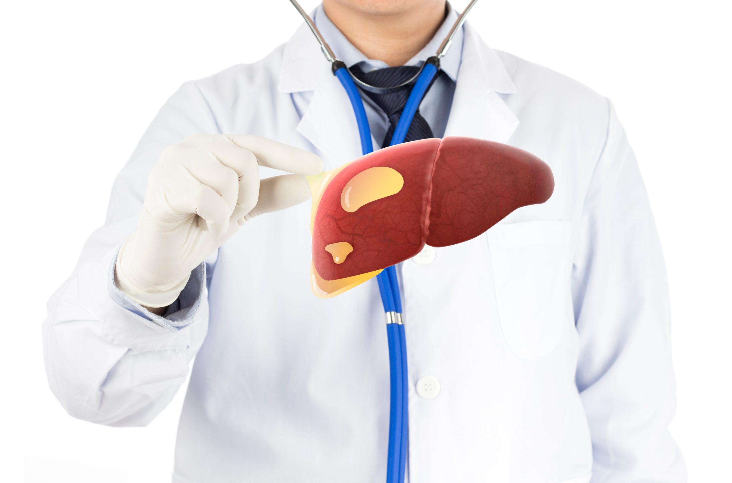 Liver Cysts: Types, Symptoms, Causes, Diagnosed & Treax`tment