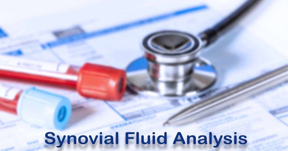 Synovial (Joint) Fluid Analysis: Test, Purpose, Procedure, Results and Risk