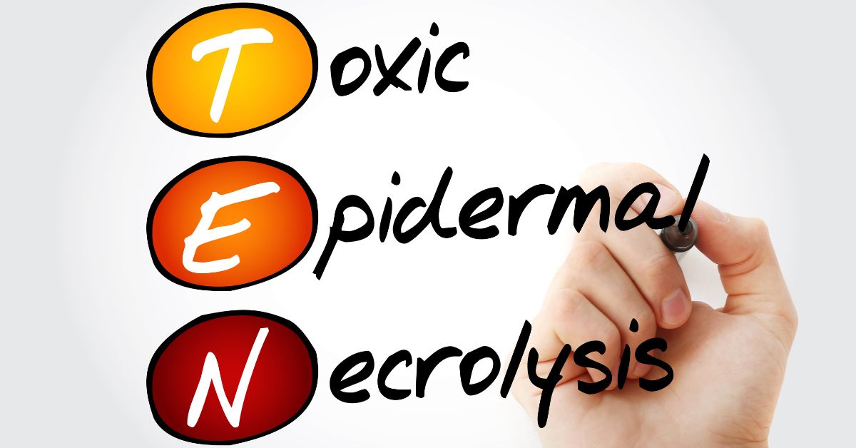 Toxic Epidermal Necrolysis (TEN) : Causes, Symptoms and Treatment