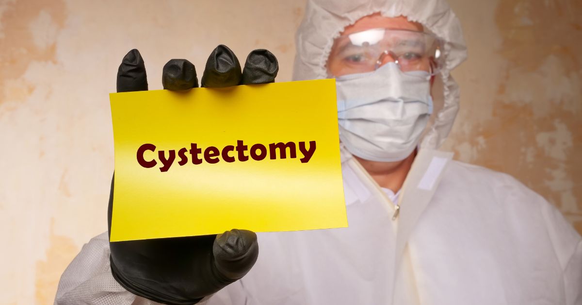 Bladder Removal Surgery (Cystectomy): Types, Benefits & Complications