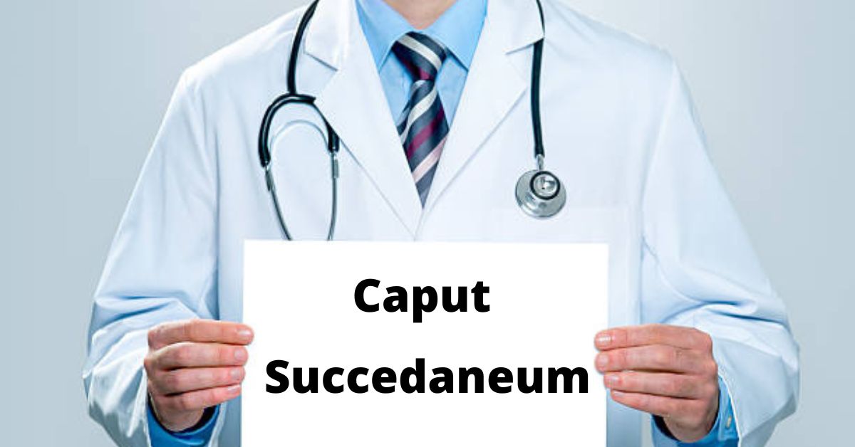 Caput Succedaneum: Causes, Symptoms and Treatment