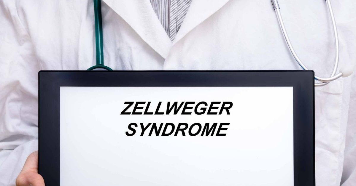 Zellweger Syndrome Disease: Causes, Symptoms, Diagnosis, Treatment