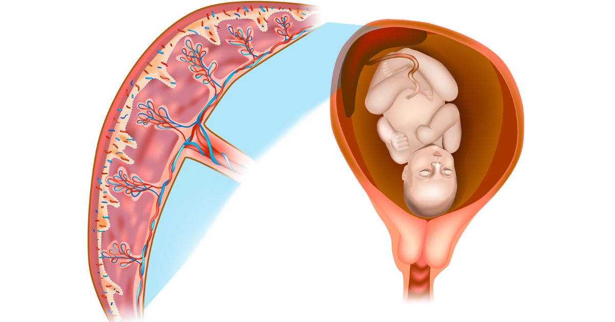 Placental Insufficiency : Symptoms, Causes and Treatment