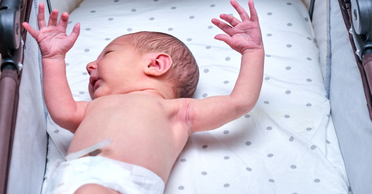 Moro Reflex (Startle Reflex) in Newborn Babies, Triggers and More