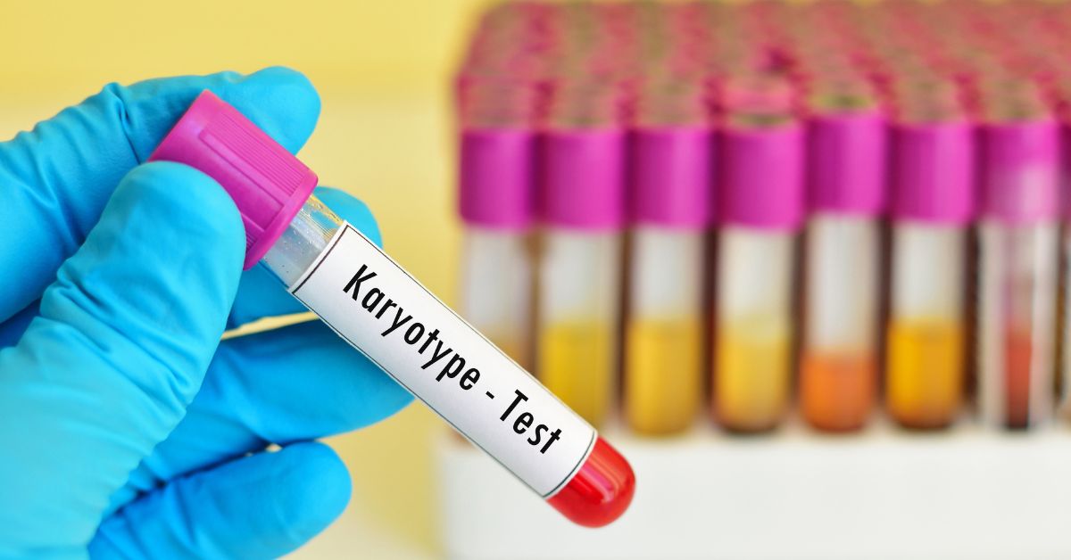 Karyotype Test: Types, Uses Purpose, Procedure and Results