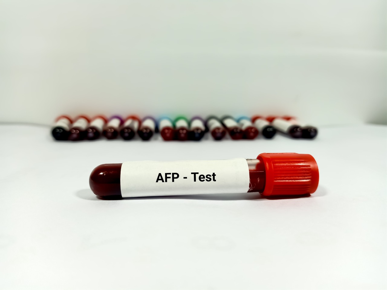 AFP Test (Alpha-Fetoprotein) : Purpose, Procedure, Risks, and Benefits