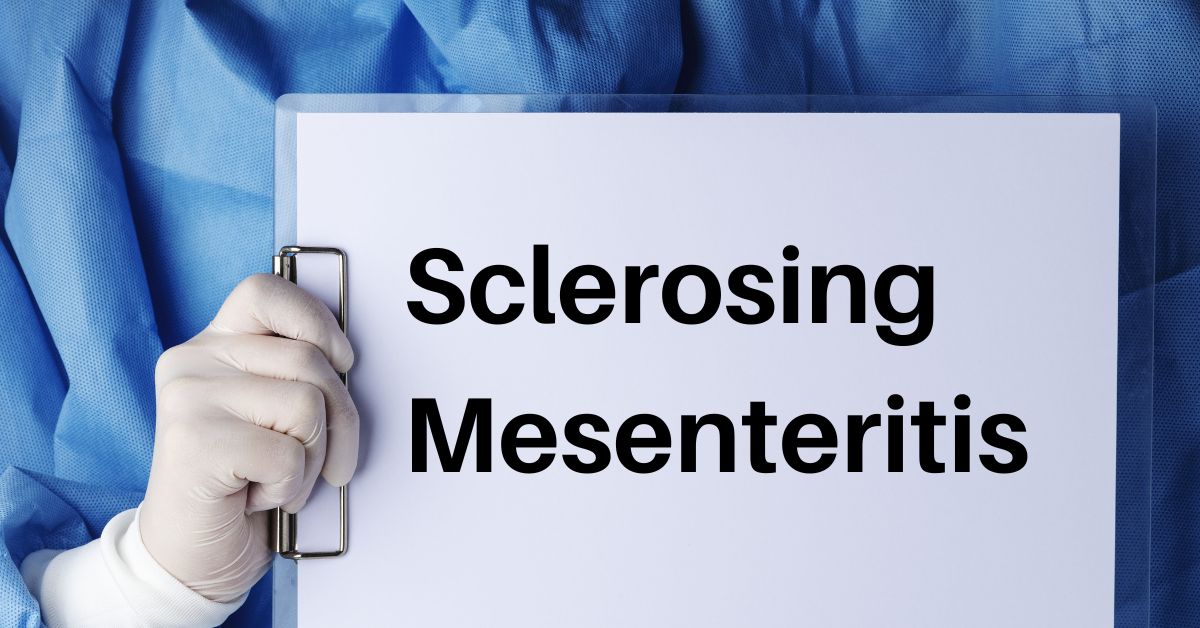 What are the Causes, Symptoms and Treatment for Sclerosing Mesenteritis?