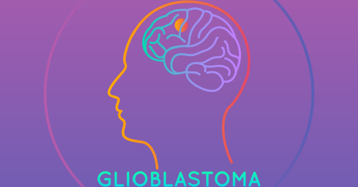 Glioblastoma: Types, Symptoms, Causes, Treatment and Diagnosis