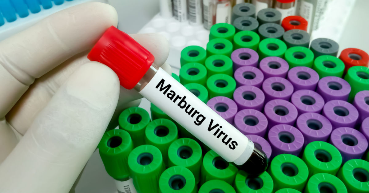 Marburg Virus Disease (MVD): Transmission, Symptoms and Treatment