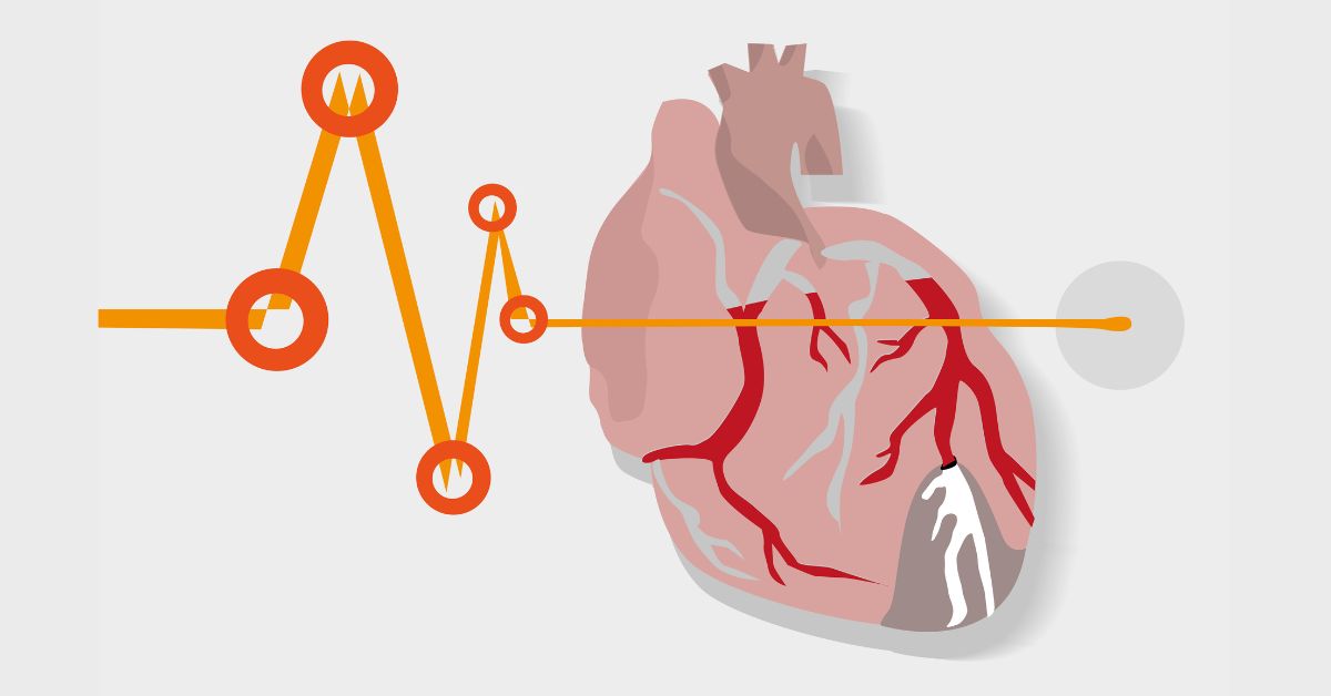 Don’t Underestimate the Risk: The Truth About Sudden Cardiac Arrest in Young People