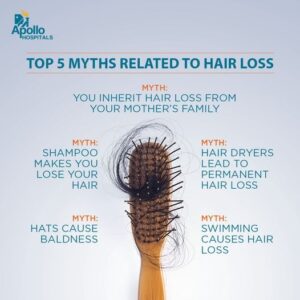 Hair Loss: Myths VS Facts