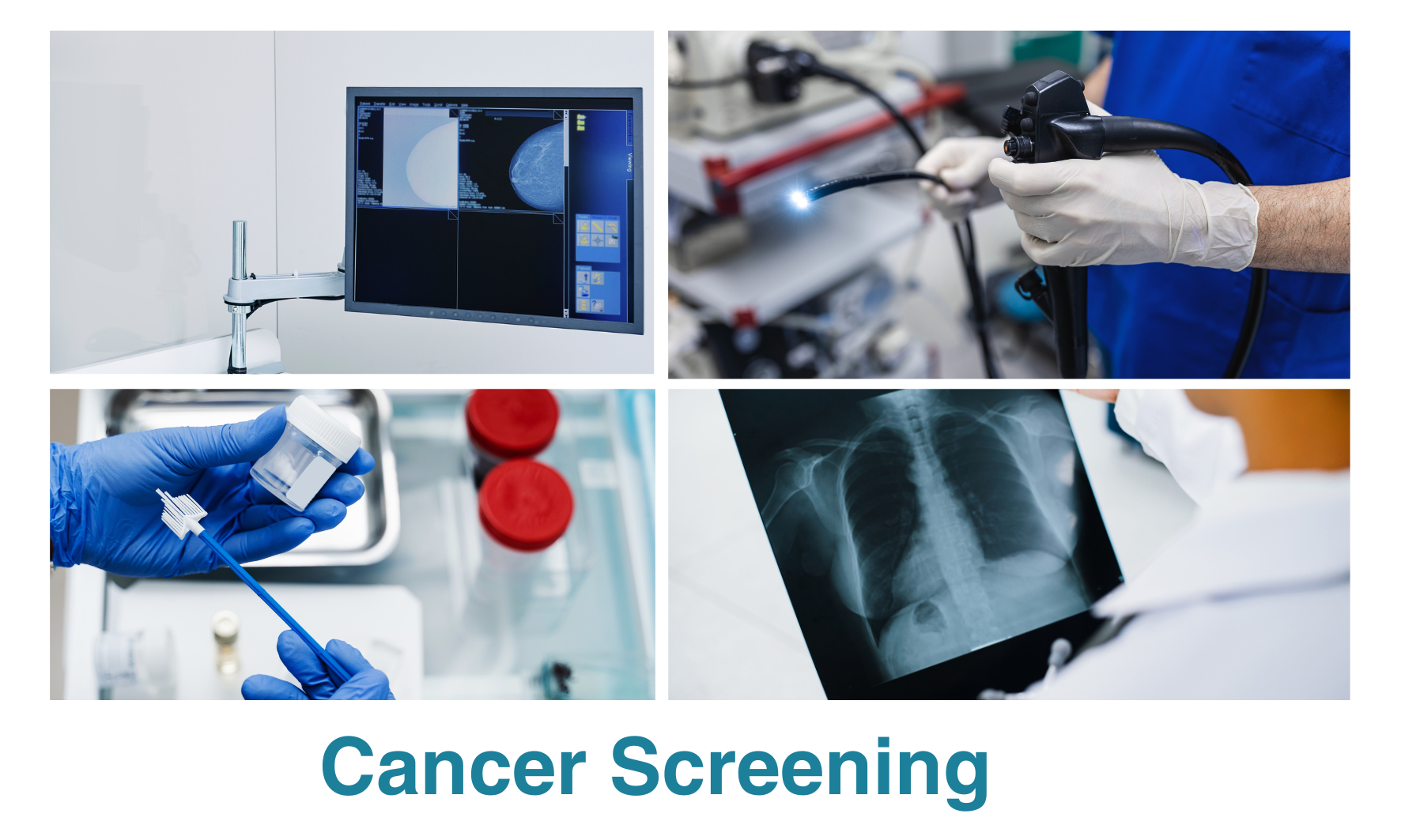 What is a Cancer Screening Test?