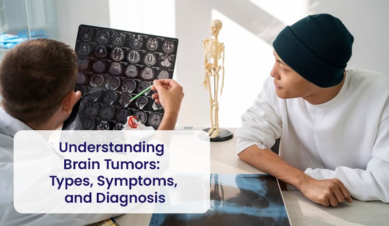 Understanding Brain Tumors: Types, Symptoms, and Diagnosis