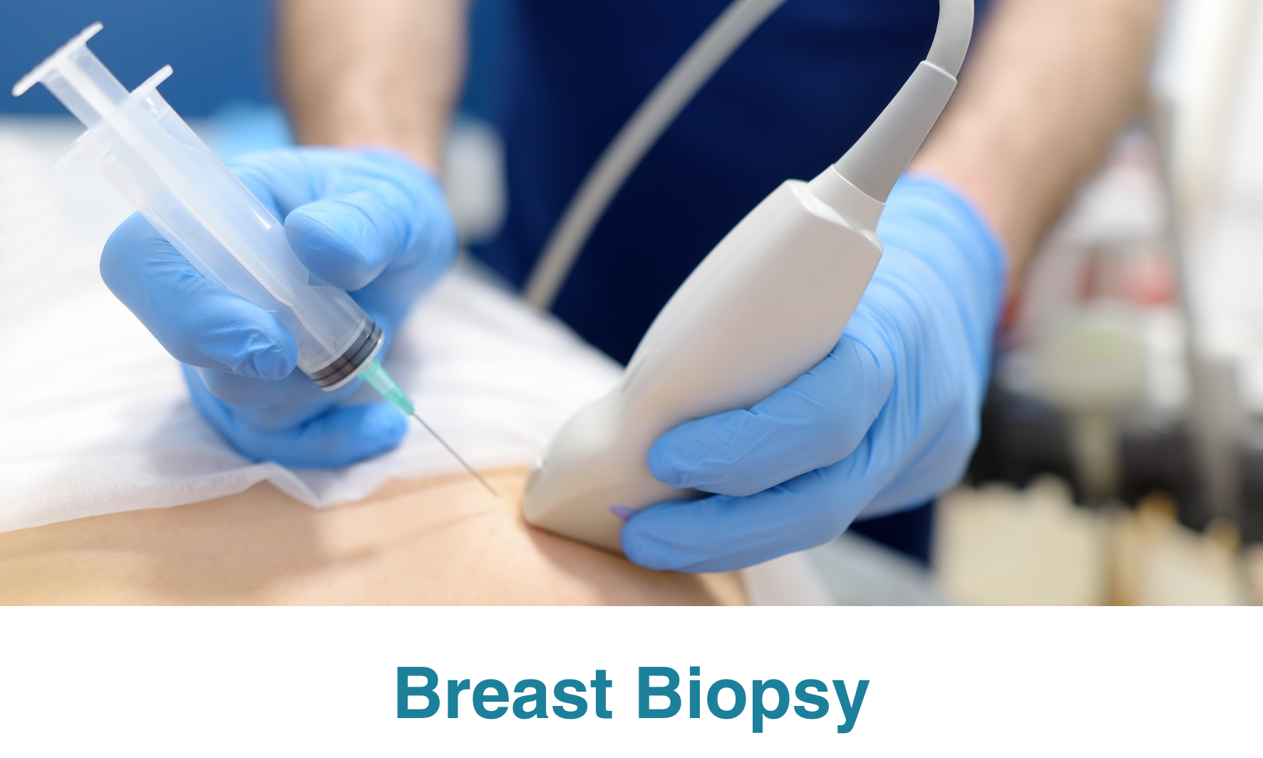 What is a Breast Biopsy?