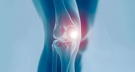 Total Knee Replacement