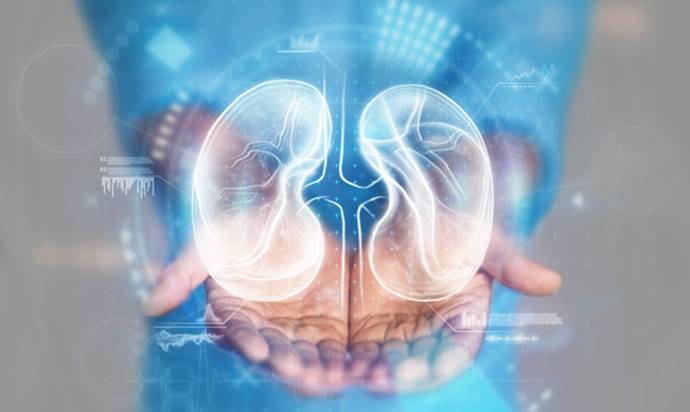 Kidney Transplant