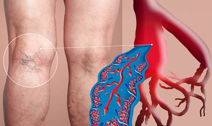 Vascular Surgery