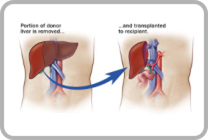 liver_portion